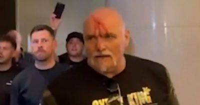 Tyson Fury's seven-word reaction to his dad's bloody face after Oleksandr Usyk team headbutt